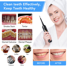 Cargar imagen en el visor de la galería, Home-use Electric Dental Clear Tools with LED Screen