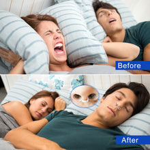 Lataa kuva Galleria-katseluun, Ant Snoring Device