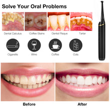Cargar imagen en el visor de la galería, Household Portable Electric Dental Care Tool